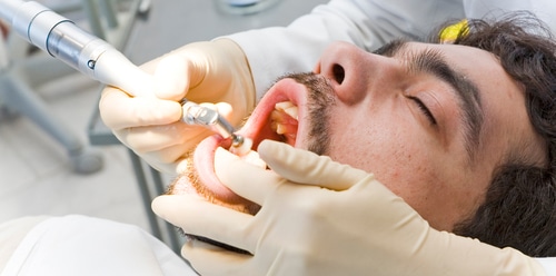El proceso de la odontología bajo sedación