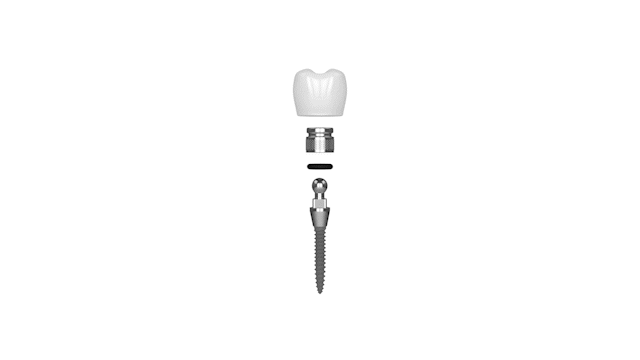 Restorative Dentistry in Butler, PA | Mini Dental Implants