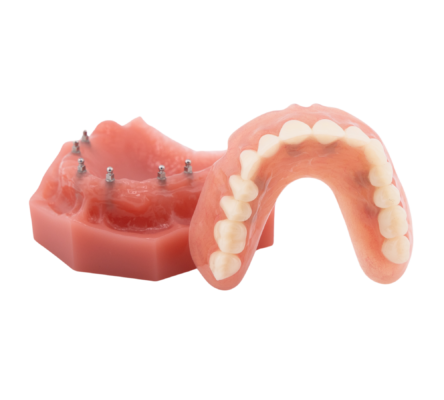 Mini Dentures in Butler, PA | Secure Your Smile With Mini Implants