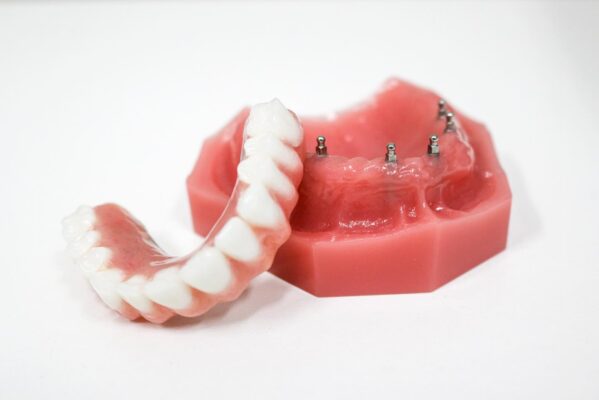 Pittsburgh Dental Implants | Affordable Mini Implants Near Me