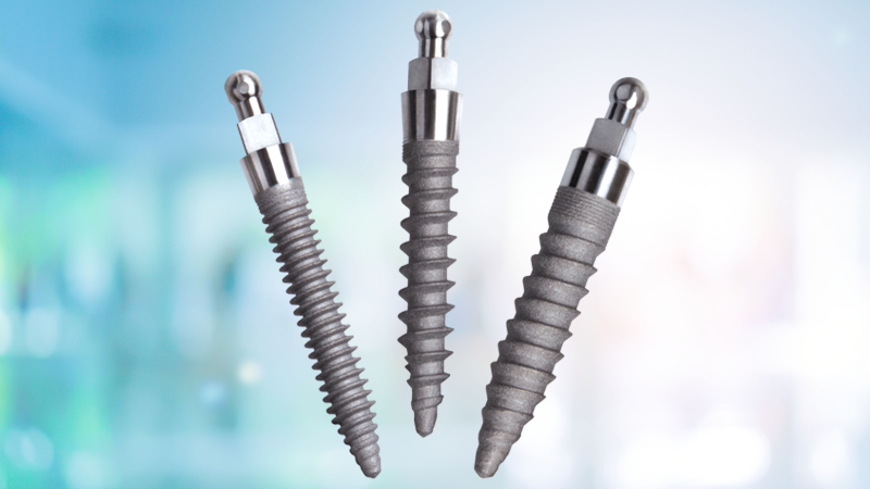 Best Implant Options in 2026 [Video Breakdown] | Mini Implants