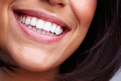 Best Teeth Whitening in Butler, PA | Brighten Your Smile Affordably