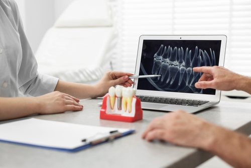 Dental Implant Alternatives in Butler, PA | Restore Your Smile